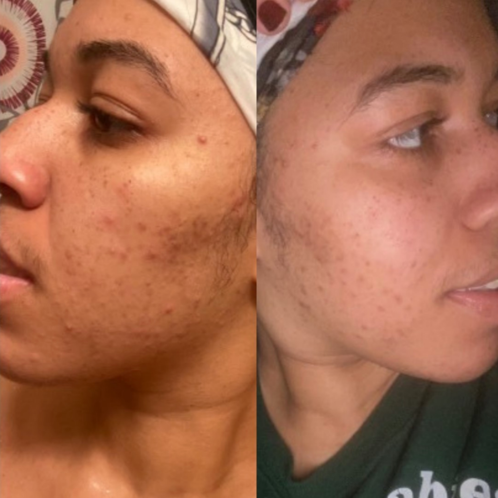 Vitamin C Exfoliating Tonic